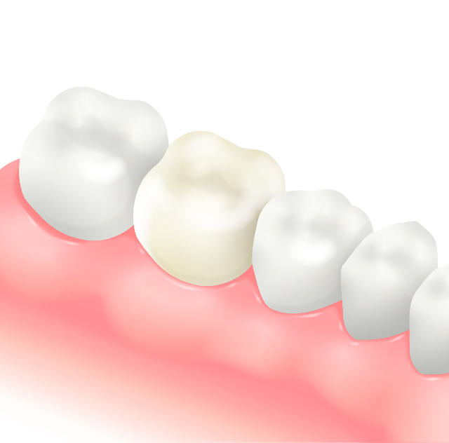 セラマージュクラウン